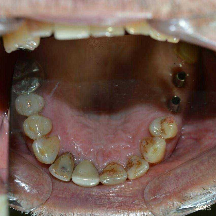 Отзывы на компанию Джи ви эс плюс в г. Находка c фото