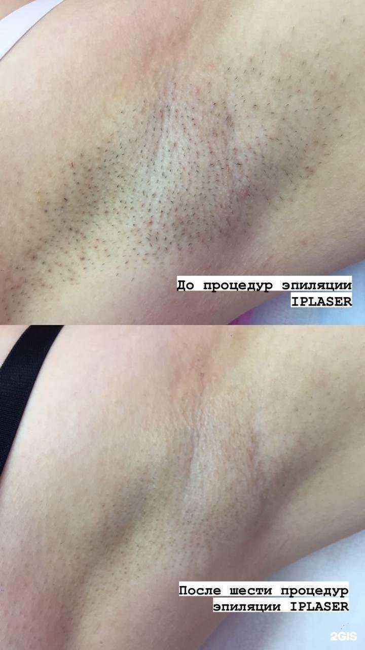 Отзывы на компанию Volosnet в Барнауле c фото