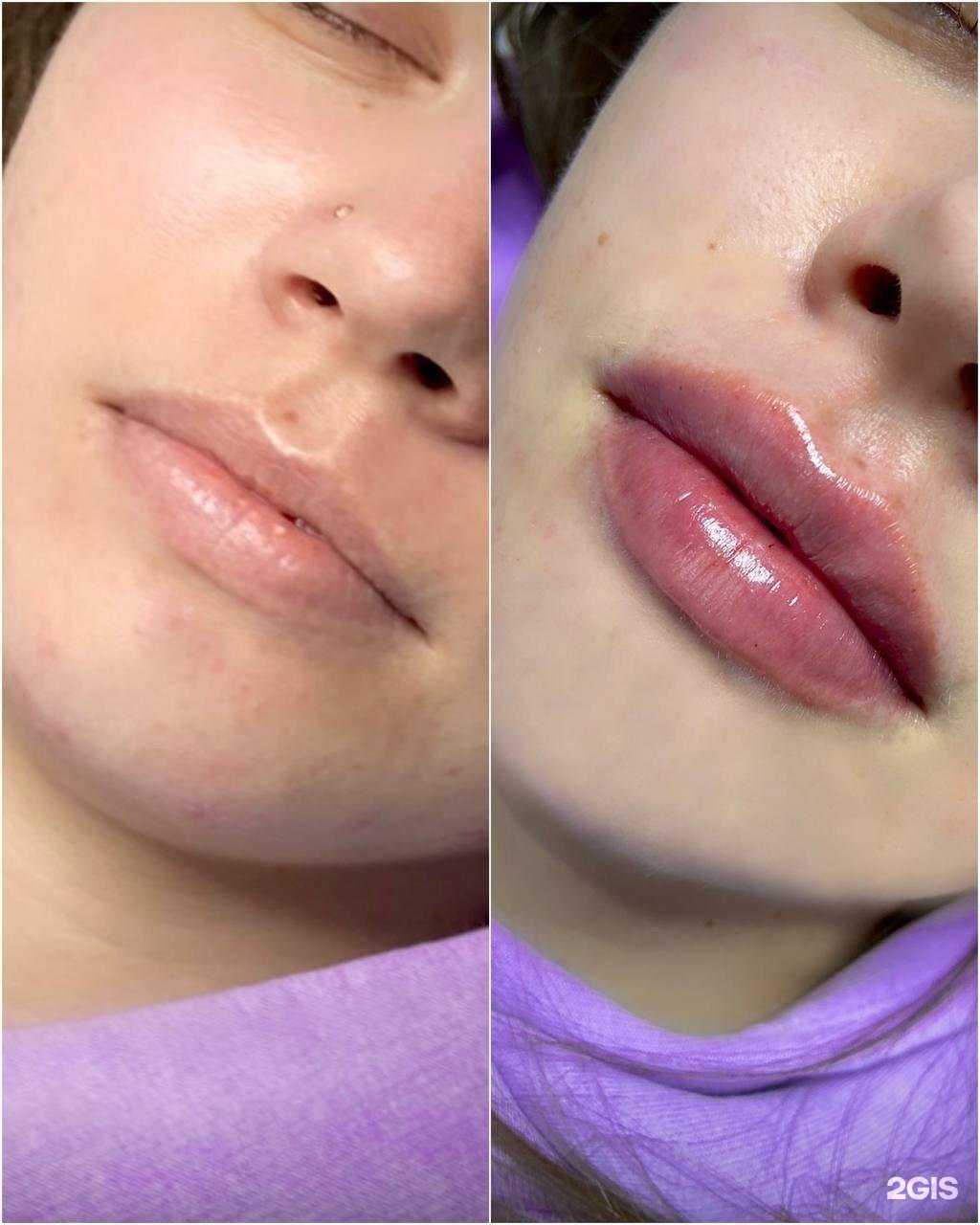 Отзывы на компанию Косметология Розе в Сочи c фото