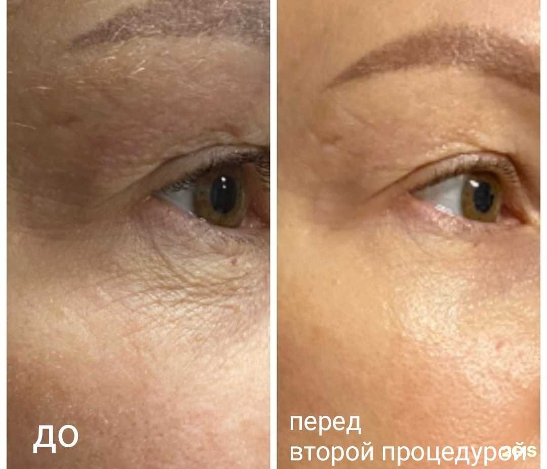 Отзывы на компанию Pro Тело в г. Пермь c фото