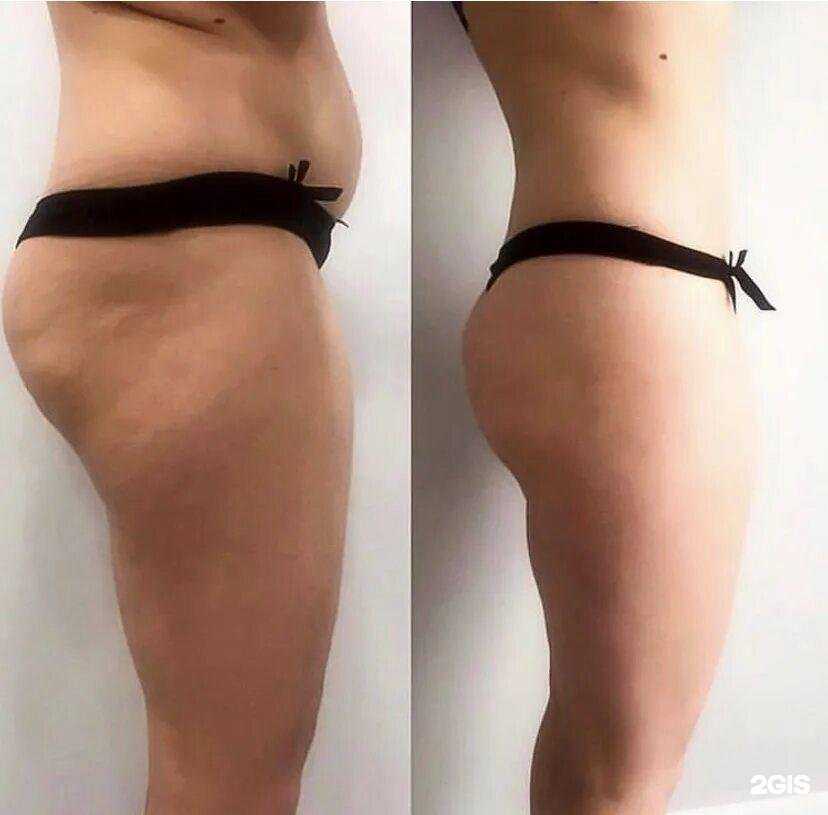 Отзывы на компанию Студия массажа и терапии в Геленджике c фото