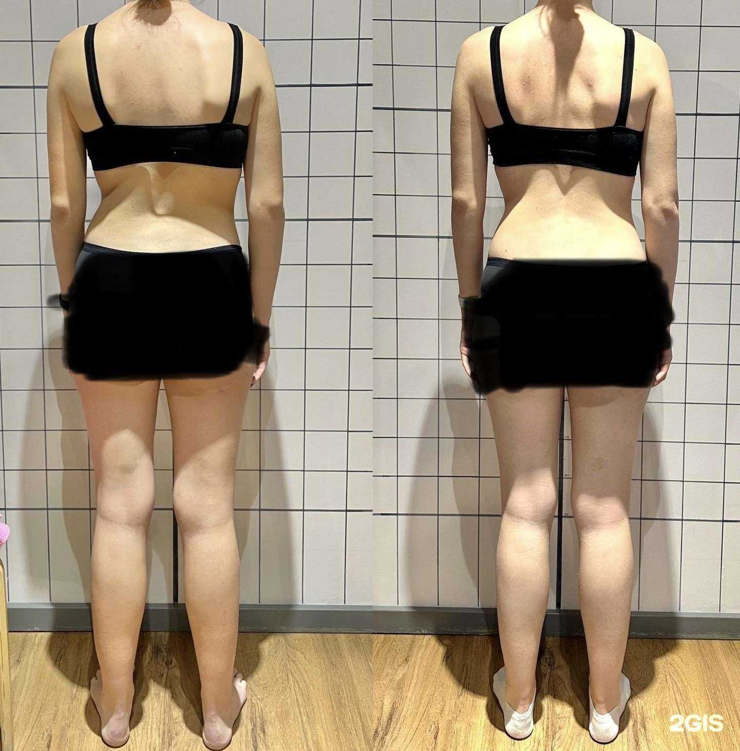 Отзывы на компанию EraЗдоровья в Архангельске c фото