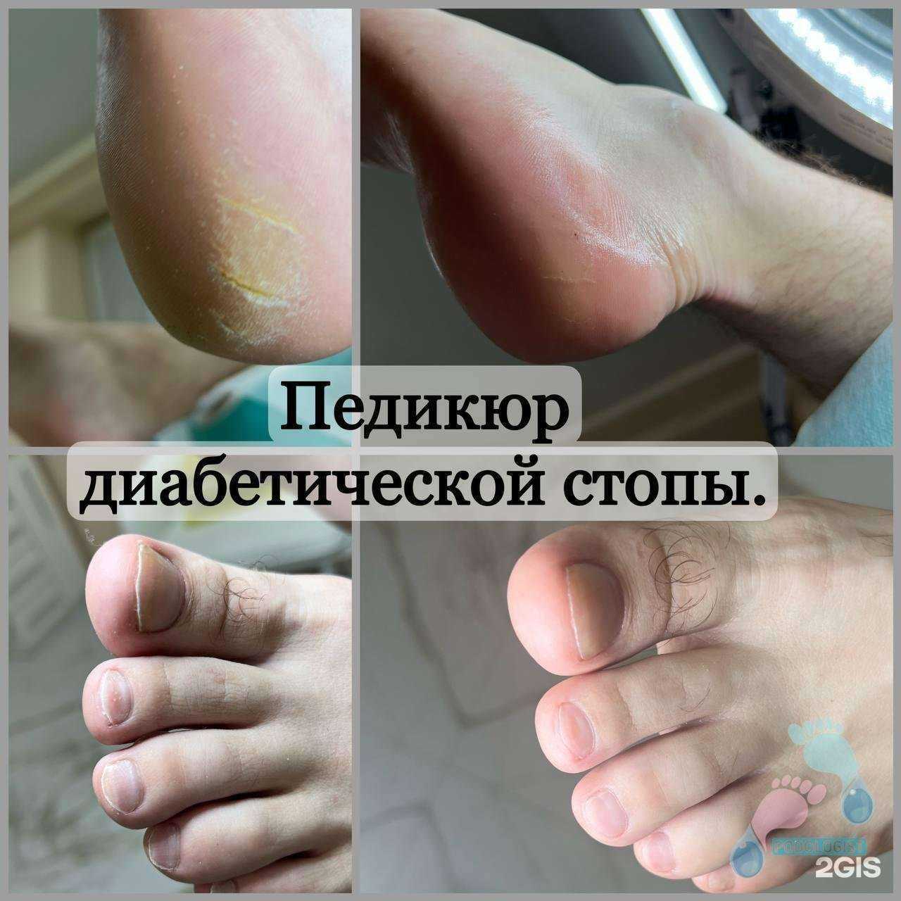 Отзывы на компанию Семейный центр подологии в г. Волгоград c фото