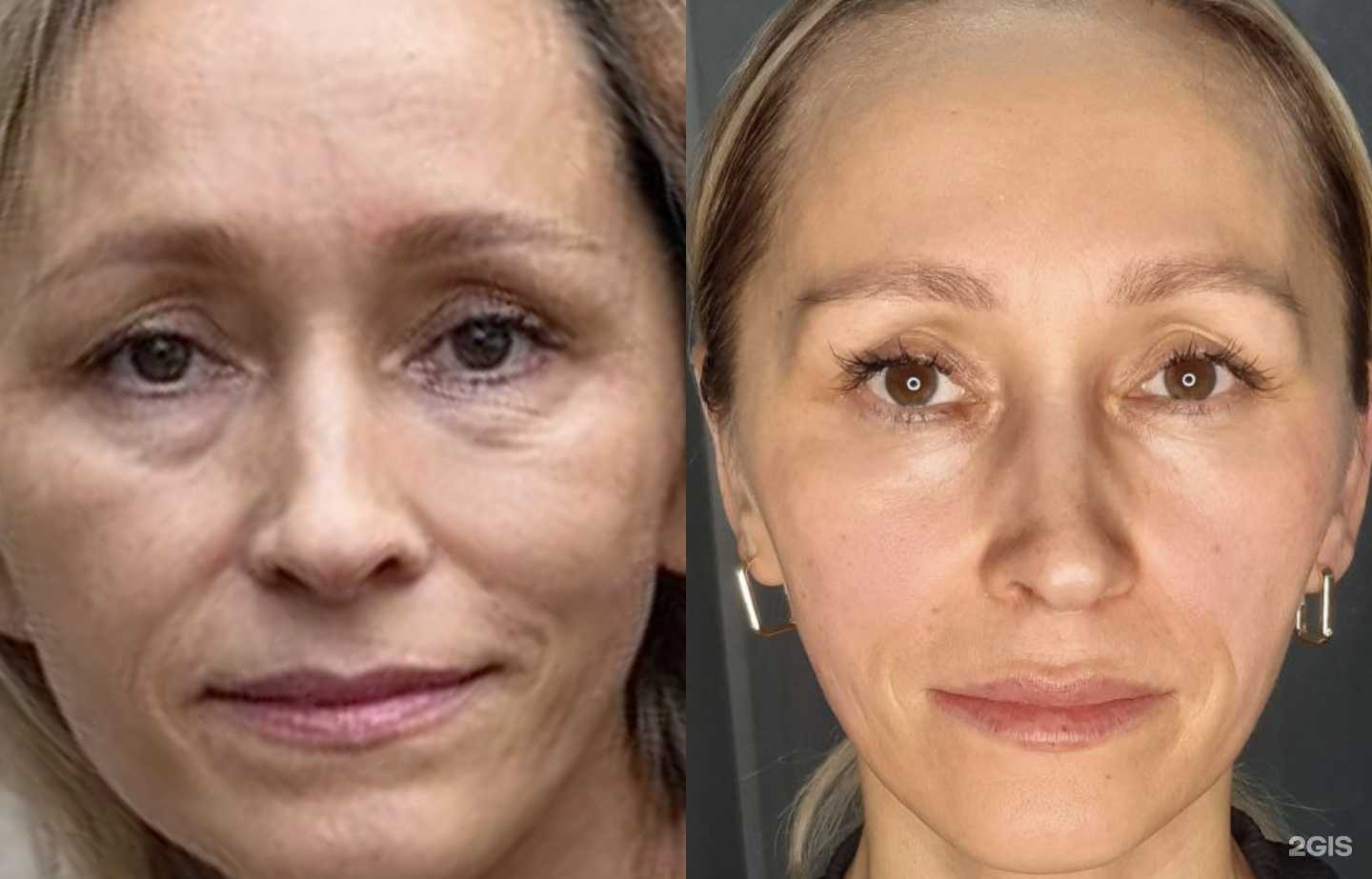 Отзывы на компанию Лицо и тело в Ижевске c фото