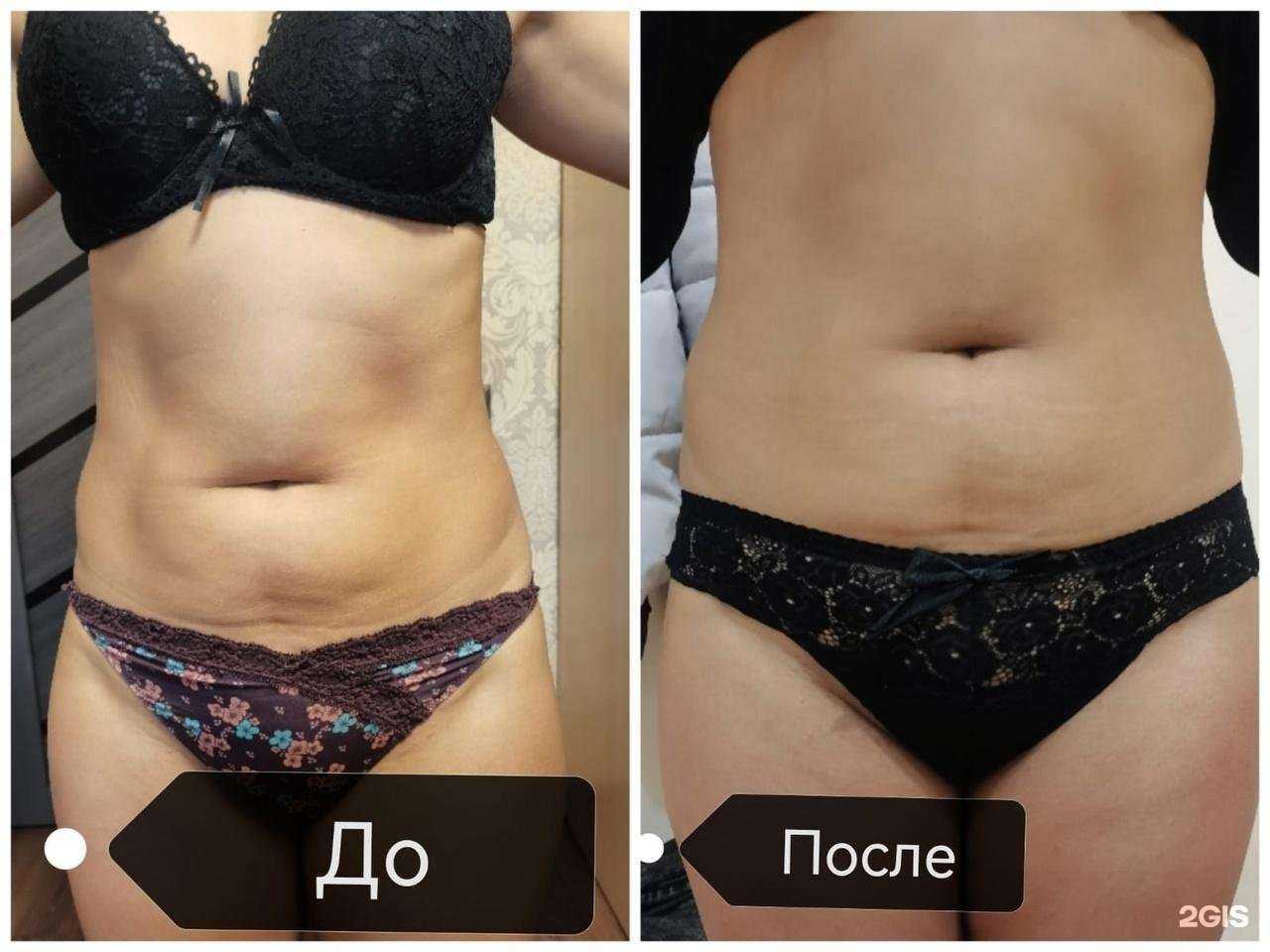 Отзывы на компанию Body&arm в Новокузнецке c фото