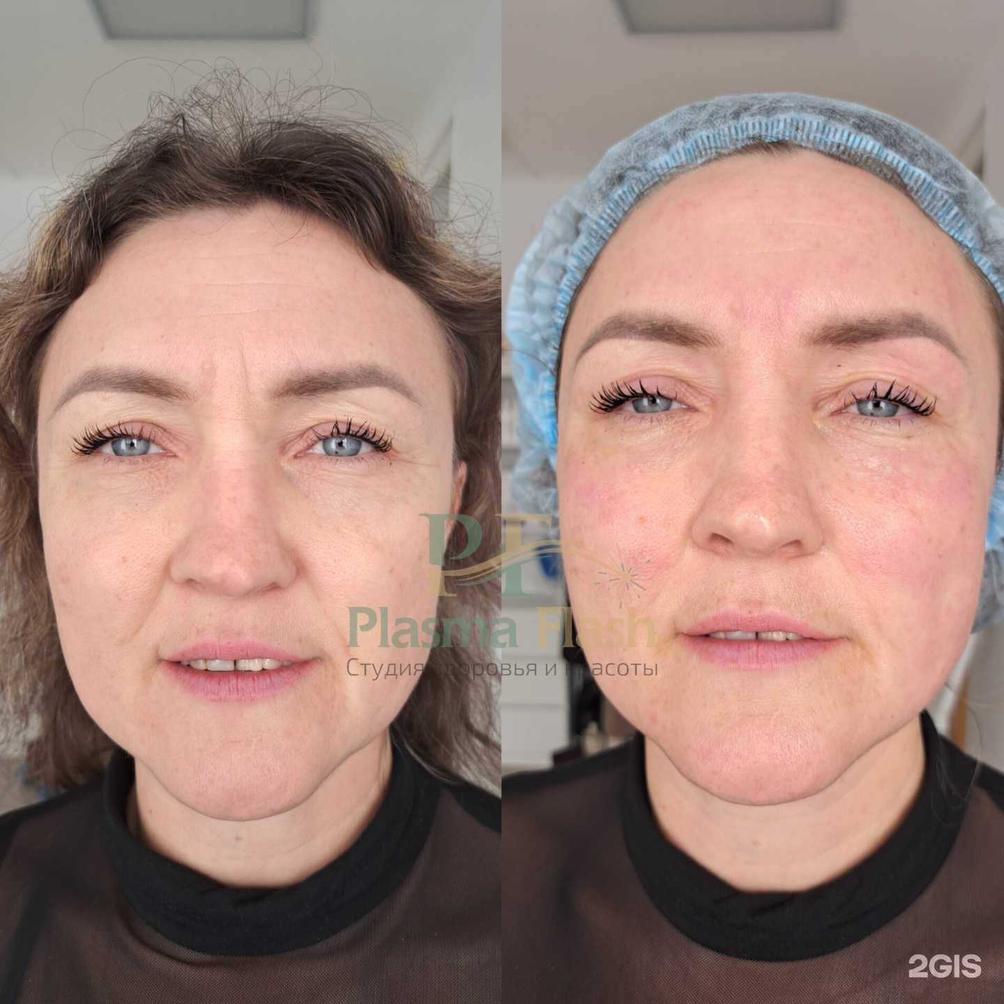 Отзывы на компанию Plasma Flash в Нижнем Тагиле c фото