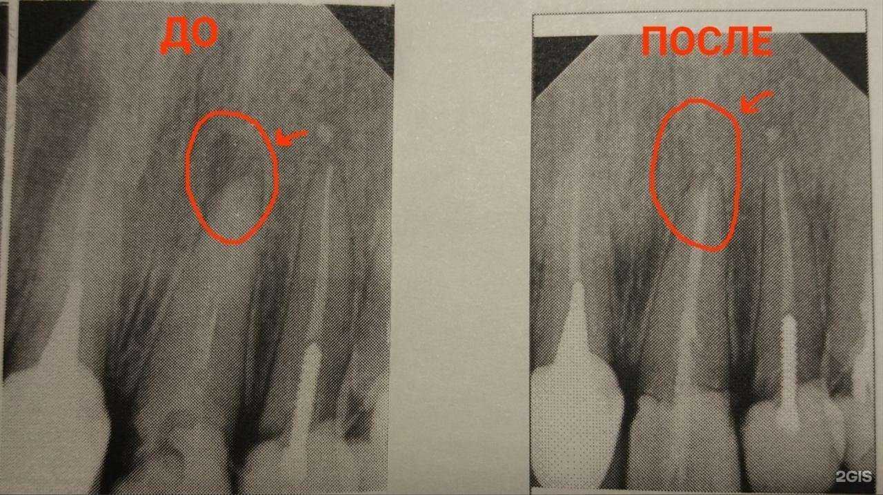 Отзывы на компанию Дантист-профи в г. Псков c фото