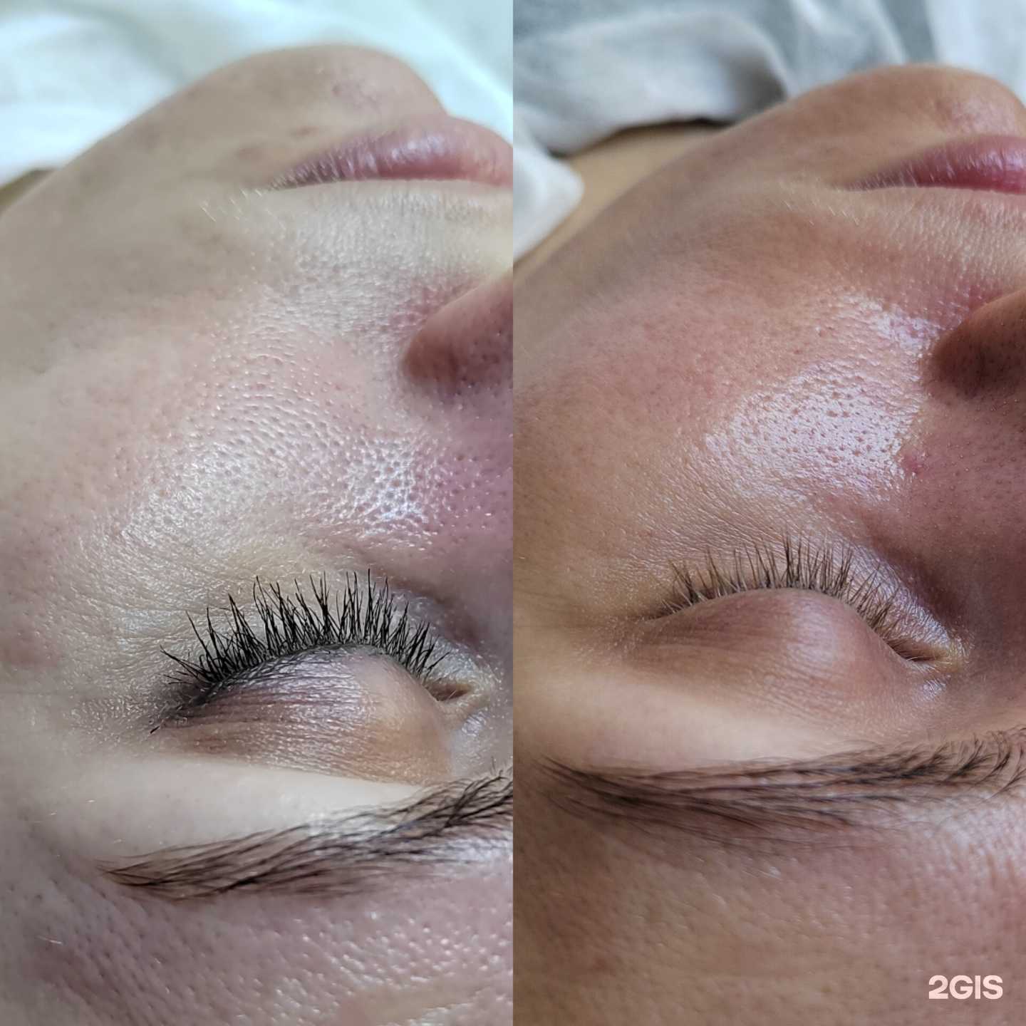 Отзывы на компанию Mikhaylova_cosmetolog в г. Новосибирск c фото