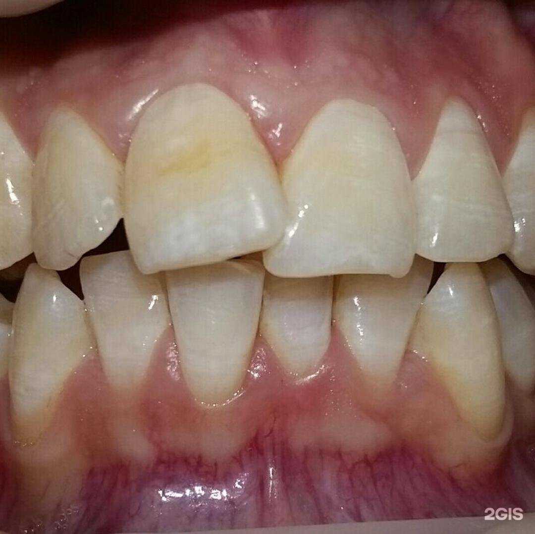 Отзывы на компанию Стоматологическая студия доктора Захарова в г. Набережные Челны c фото