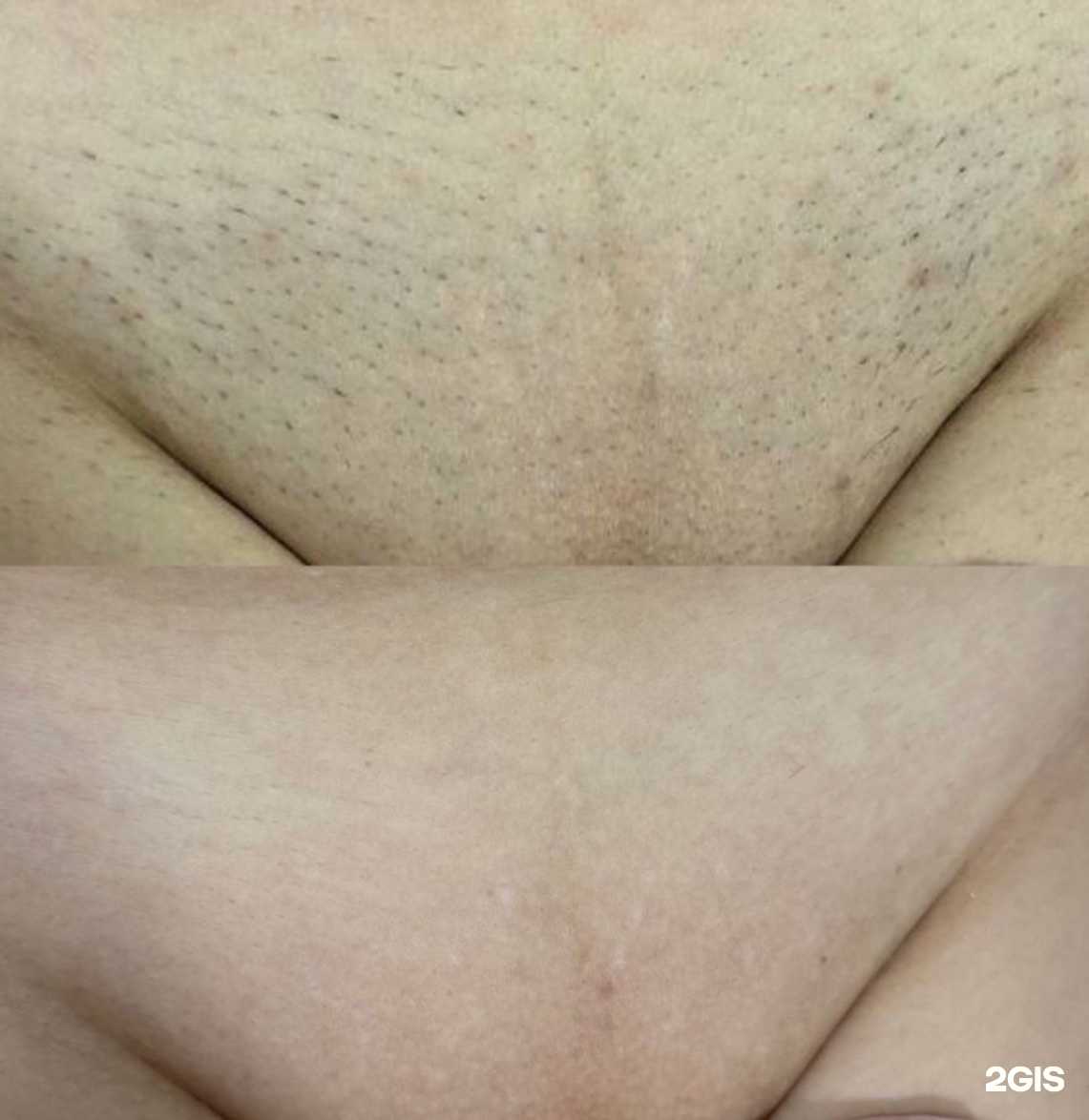 Отзывы на компанию Студия лазерная эпиляция в г. Нижний Новгород c фото