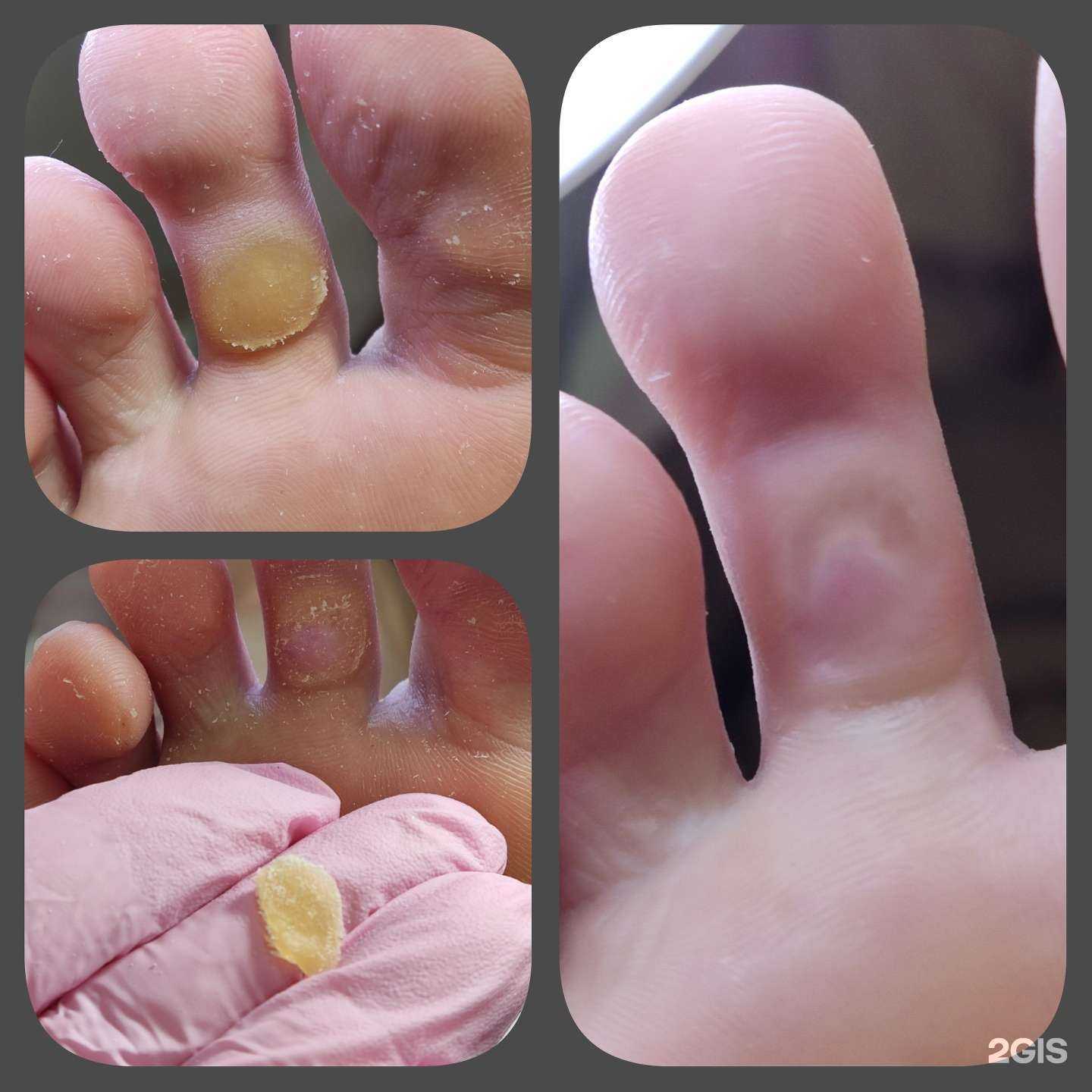 Отзывы на компанию Кабинет педикюра и подологии в Екатеринбурге c фото