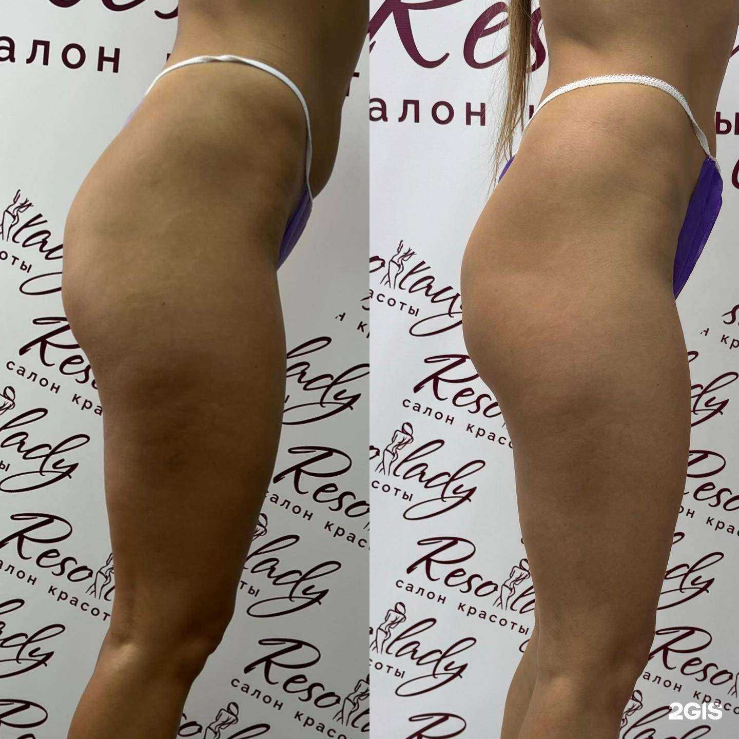 Отзывы на компанию Resolady в г. Ижевск c фото