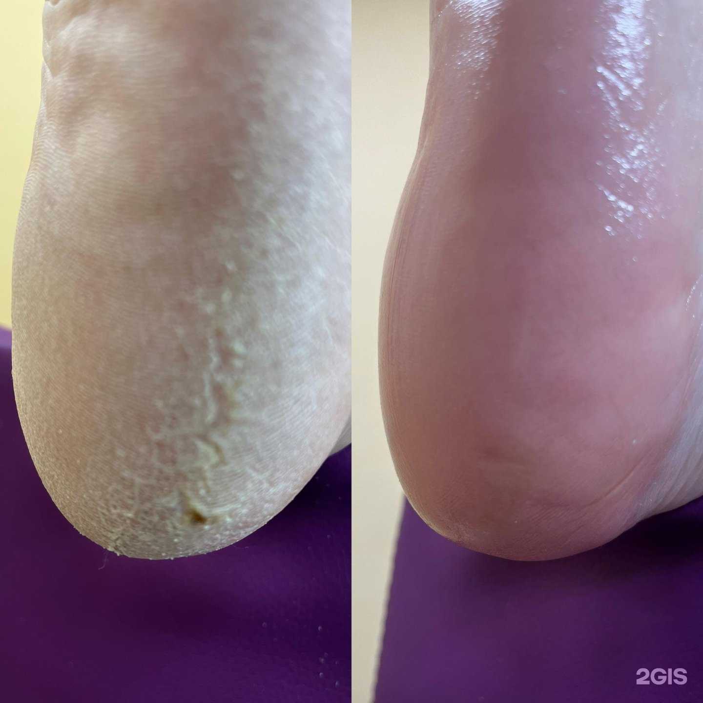 Отзывы на компанию Кабинет подологии и педикюра в Дудинке c фото