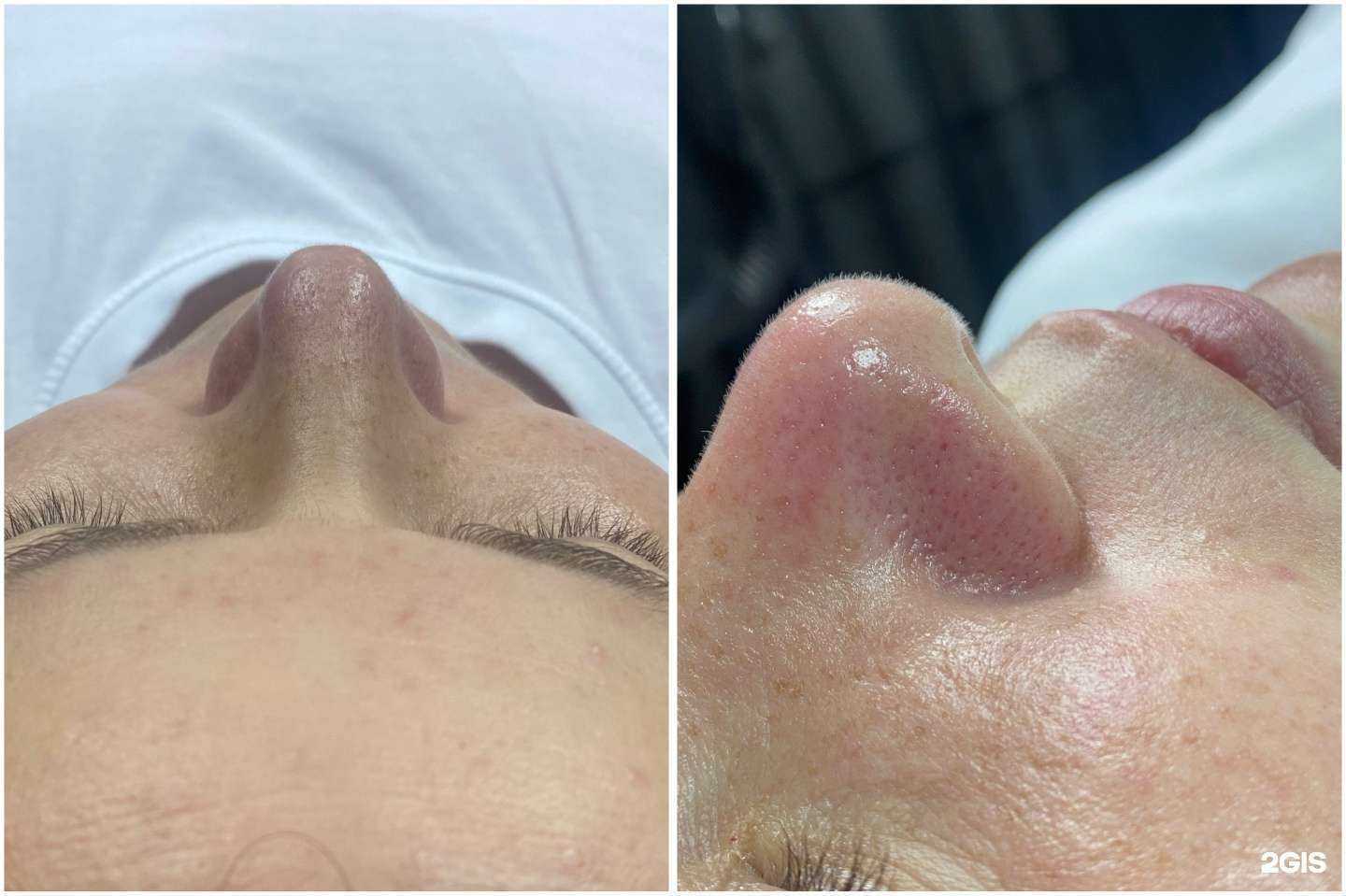 Отзывы на компанию Ваш косметолог Евгения Ищук в Тюмени c фото