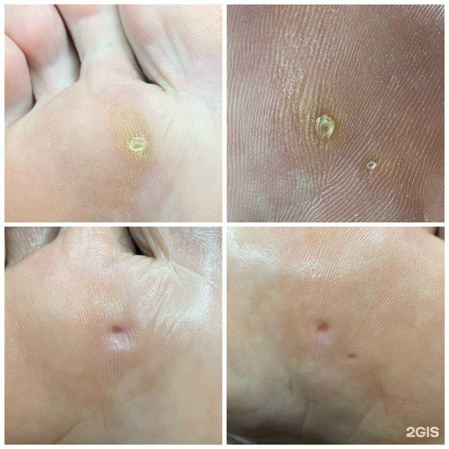 Отзывы на компанию Подологический кабинет в Тюмени c фото