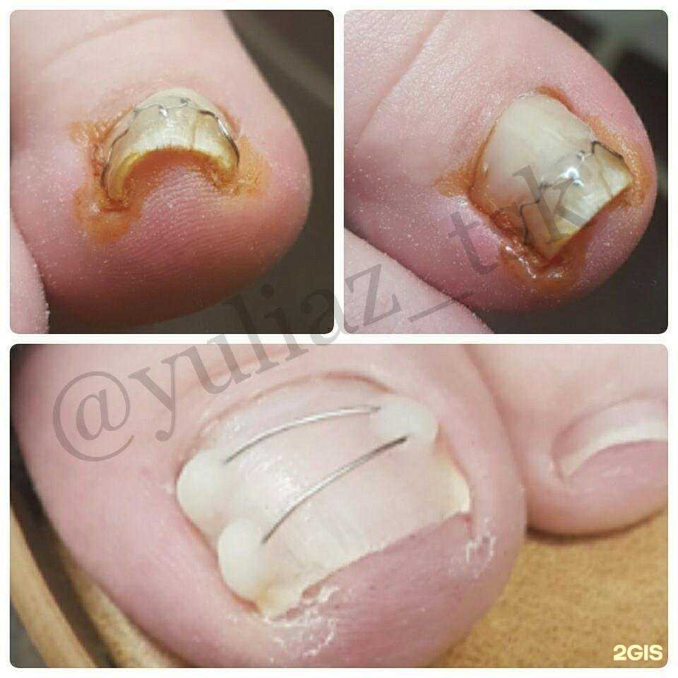 Отзывы на компанию Foot line в г. Томск c фото