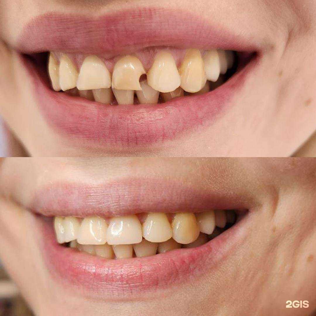 Отзывы на компанию Новые Зубы в Ростове-на-Дону c фото
