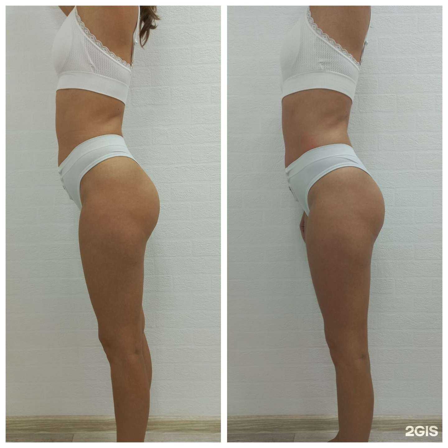 Отзывы на компанию ProГладкость в Перми c фото