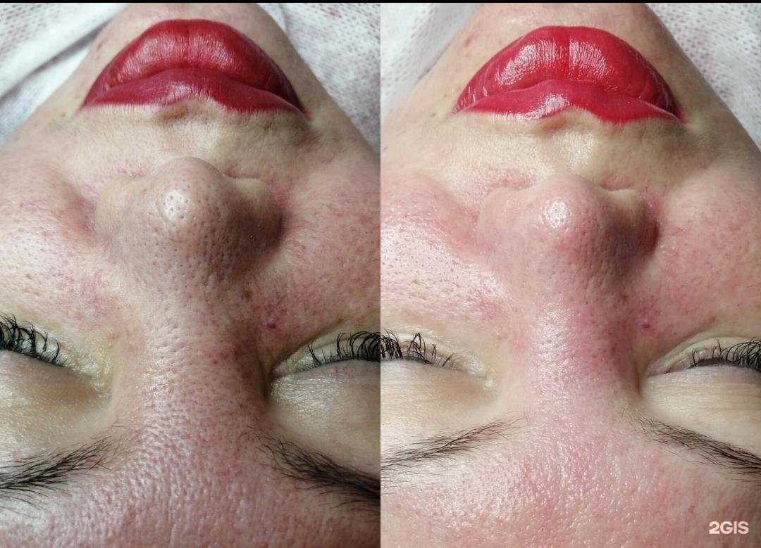 Отзывы на компанию Марафет в Нижневартовске c фото