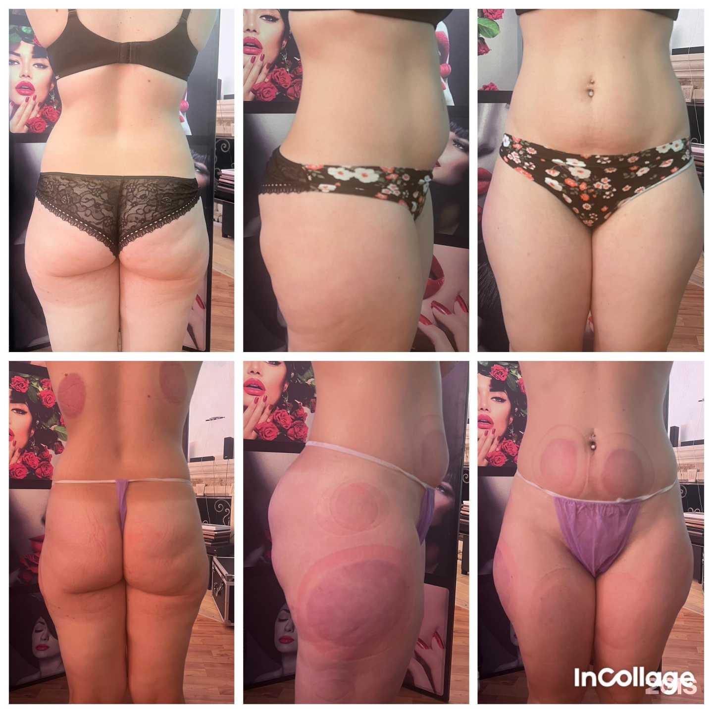 Отзывы на компанию Krioslim в г. Краснодар c фото