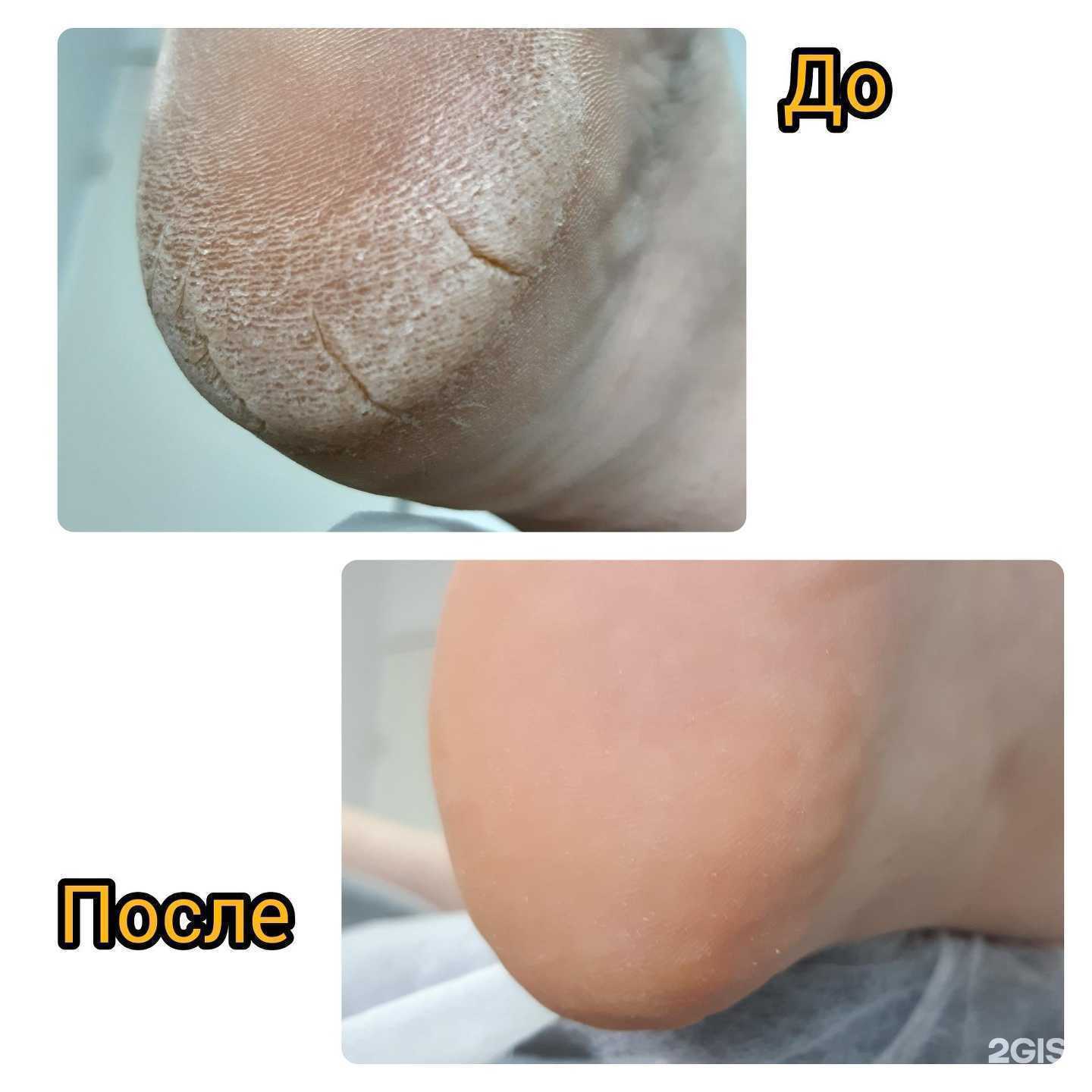 Отзывы на компанию Кабинет здоровой стопы в г. Тольятти c фото