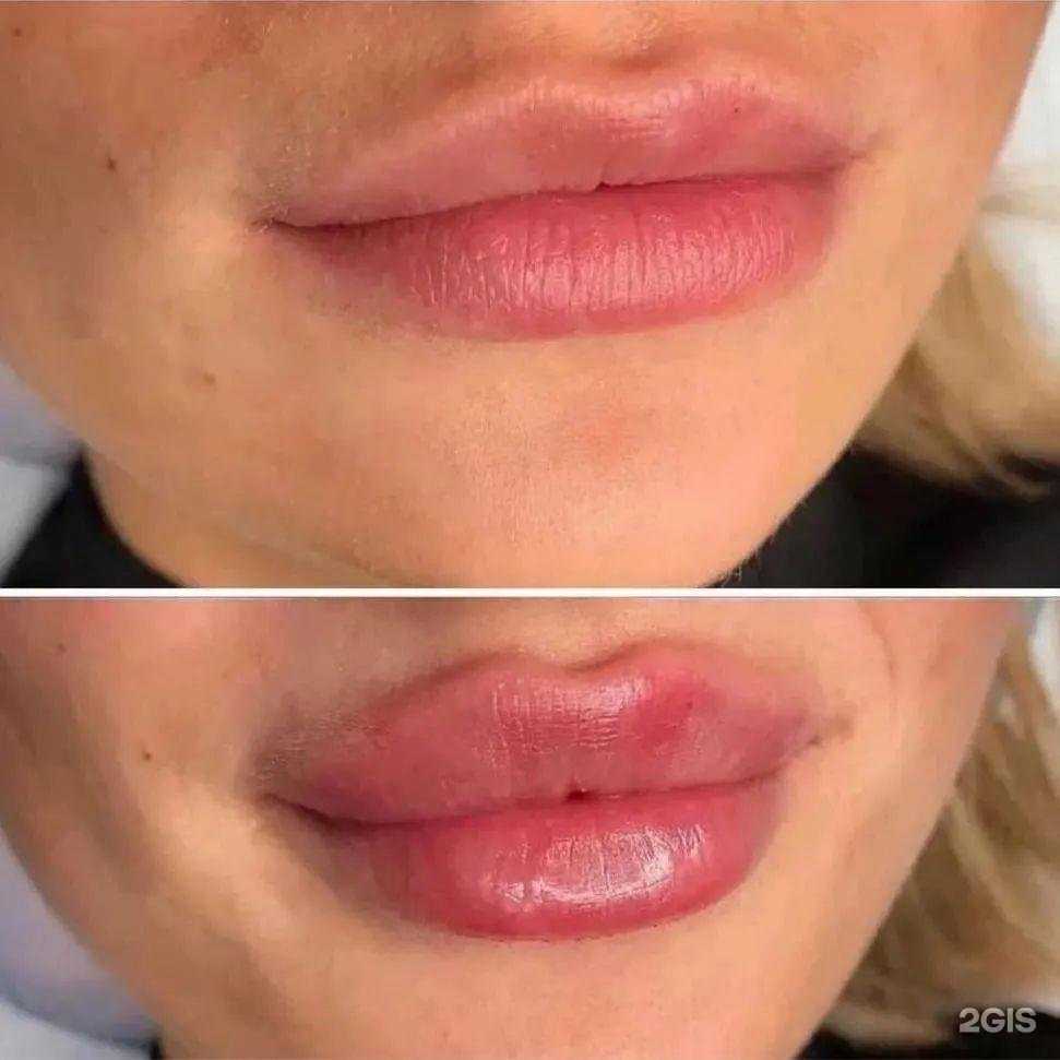 Отзывы на компанию BodySlim в Глазове c фото