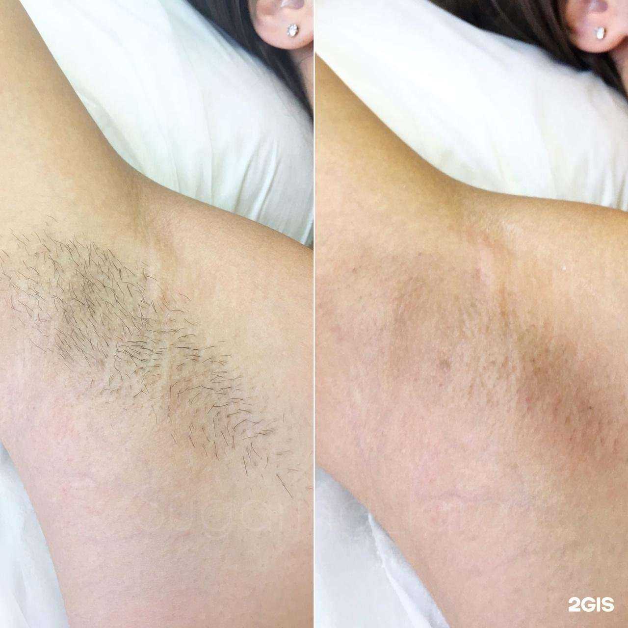 Отзывы на компанию Pro Depil в Чебоксарах c фото