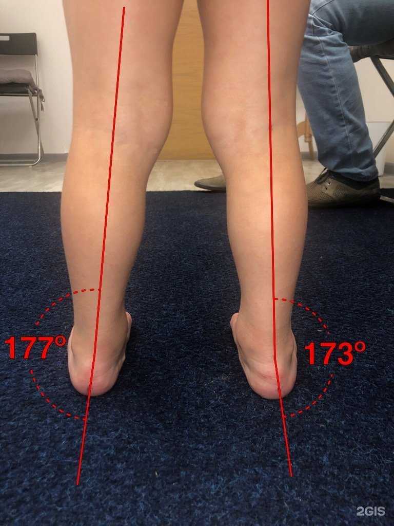 Отзывы на компанию Fiziostep-Orto в Казани c фото