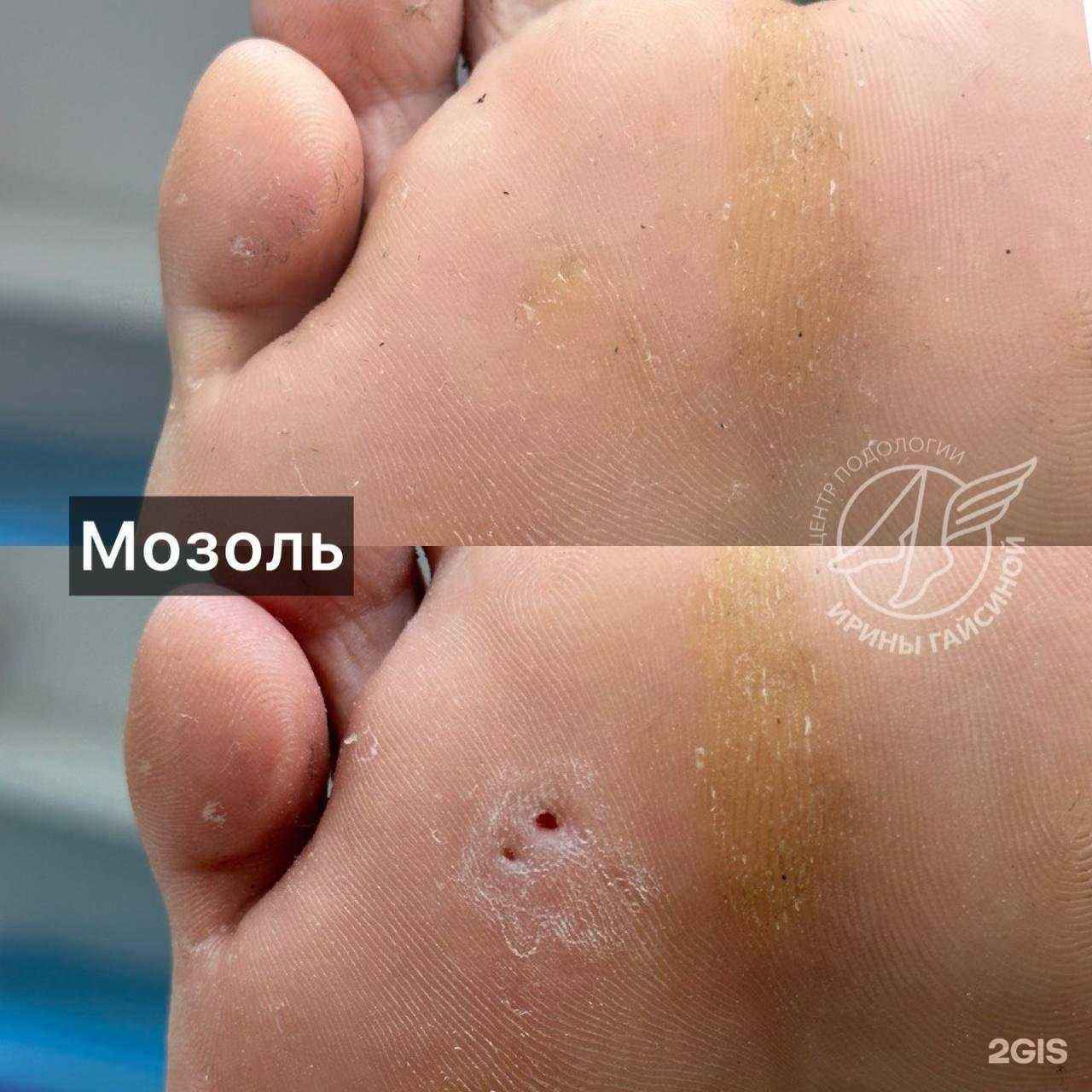 Отзывы на компанию Центр подологии Ирины Гайсиной в Оренбурге c фото