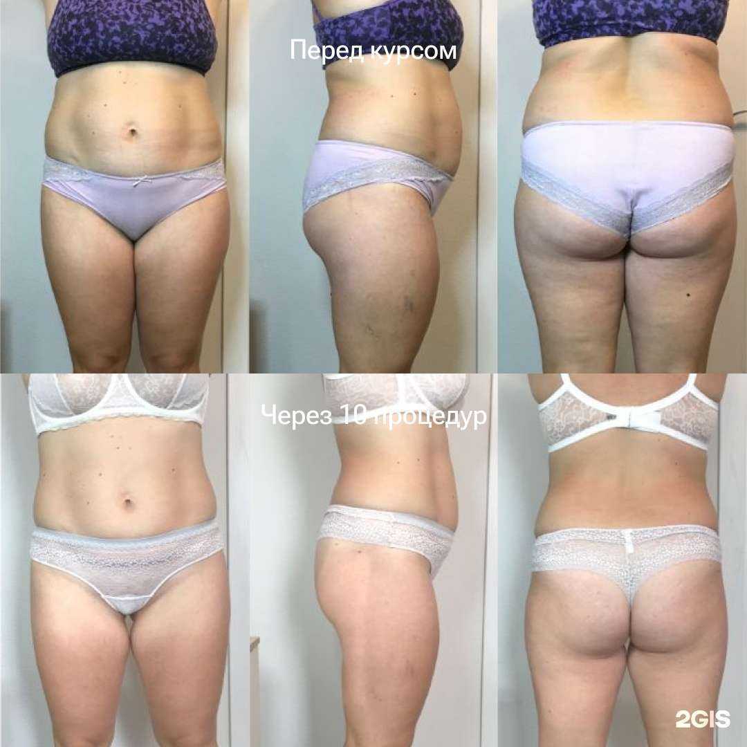 Отзывы на компанию Студия эстетики тела в Казани c фото