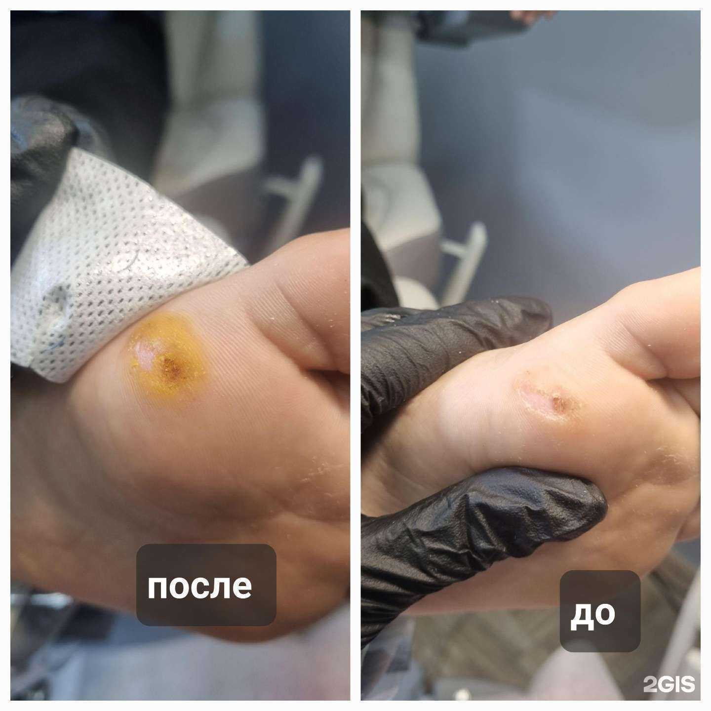 Отзывы на компанию PodoPerfect.uu в Улан-Удэ c фото