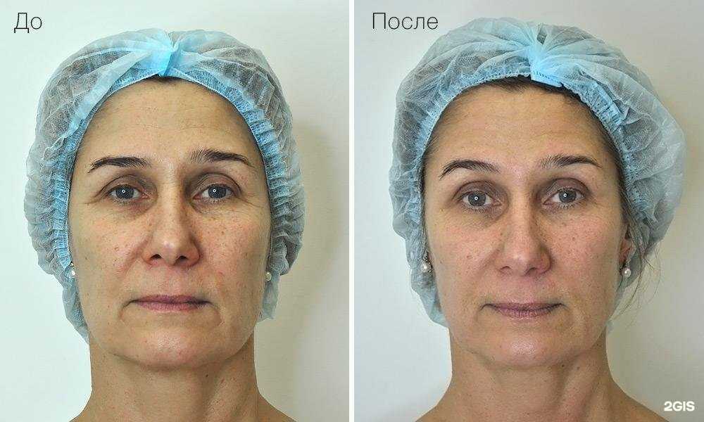 Отзывы на компанию Laser Star в Наро-Фоминске c фото