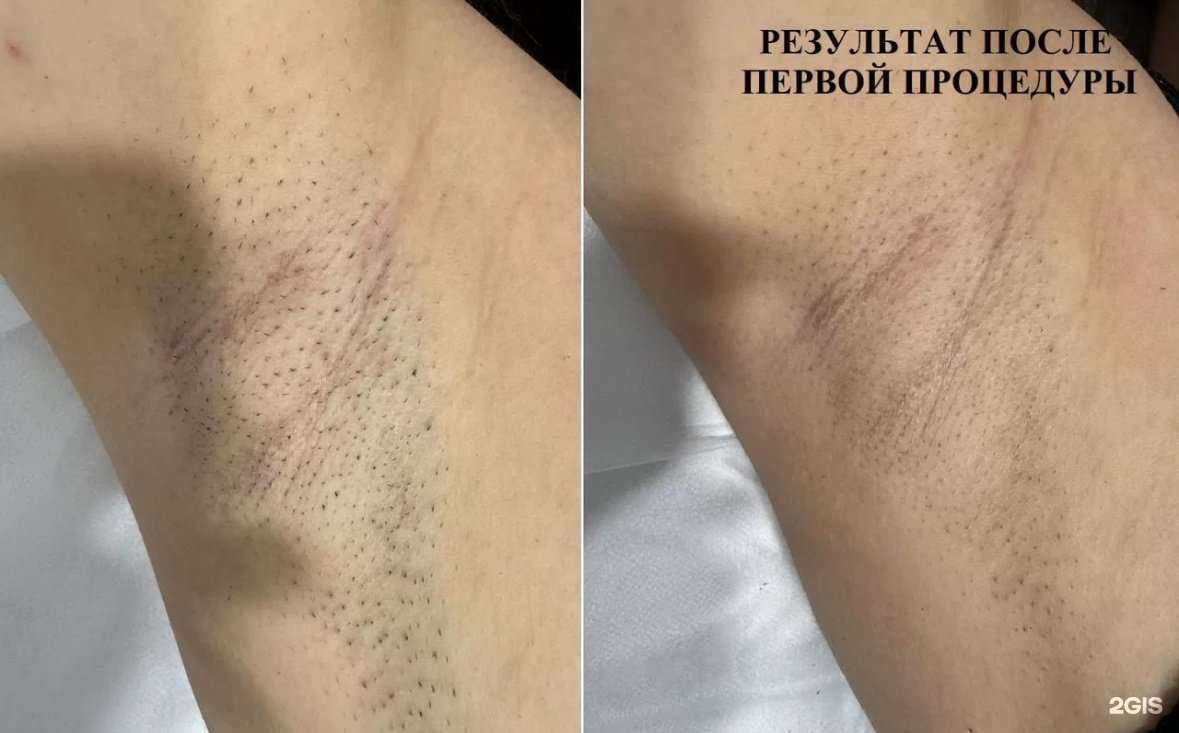 Отзывы на компанию Stav_Laser в Ставрополе c фото