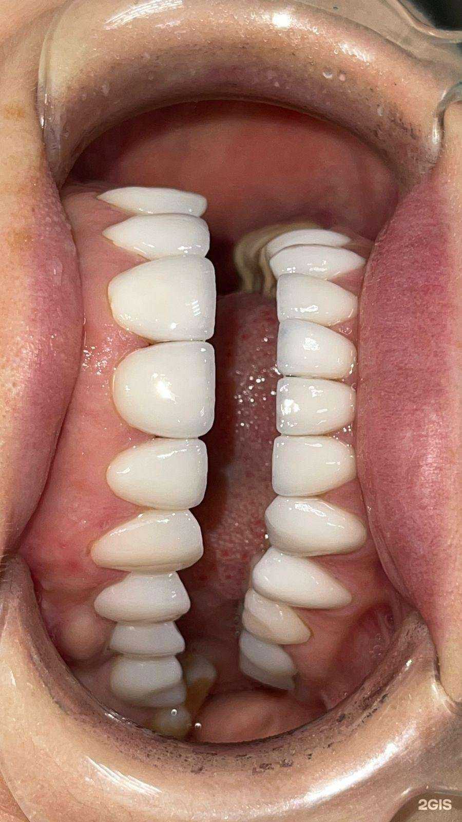 Отзывы на компанию Мк Дент в г. Новороссийск c фото