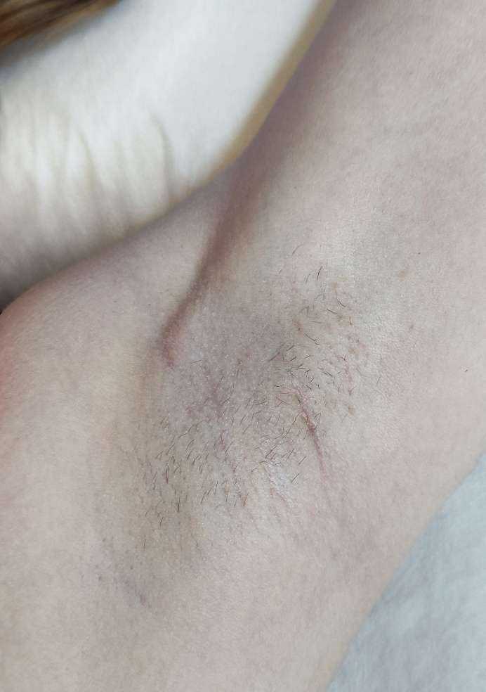 Отзывы на компанию Кабинет эпиляции в Тюмени c фото