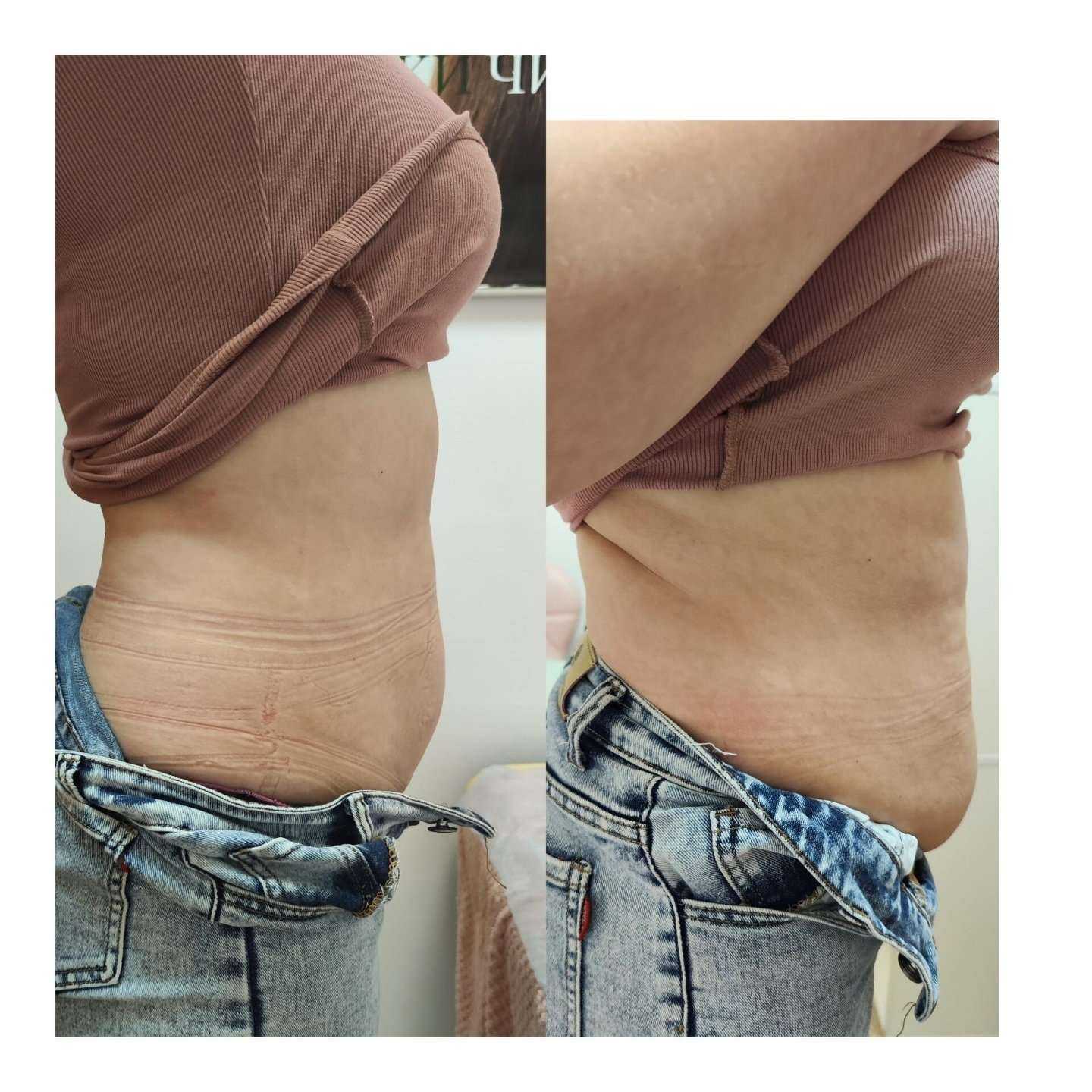 Отзывы на компанию Кабинет косметолога в Новосибирске c фото