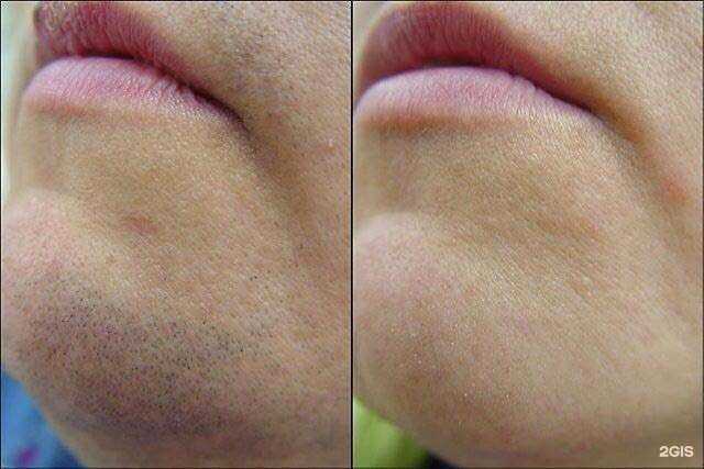 Отзывы на компанию Beauty innovatione epil в Владивостоке c фото