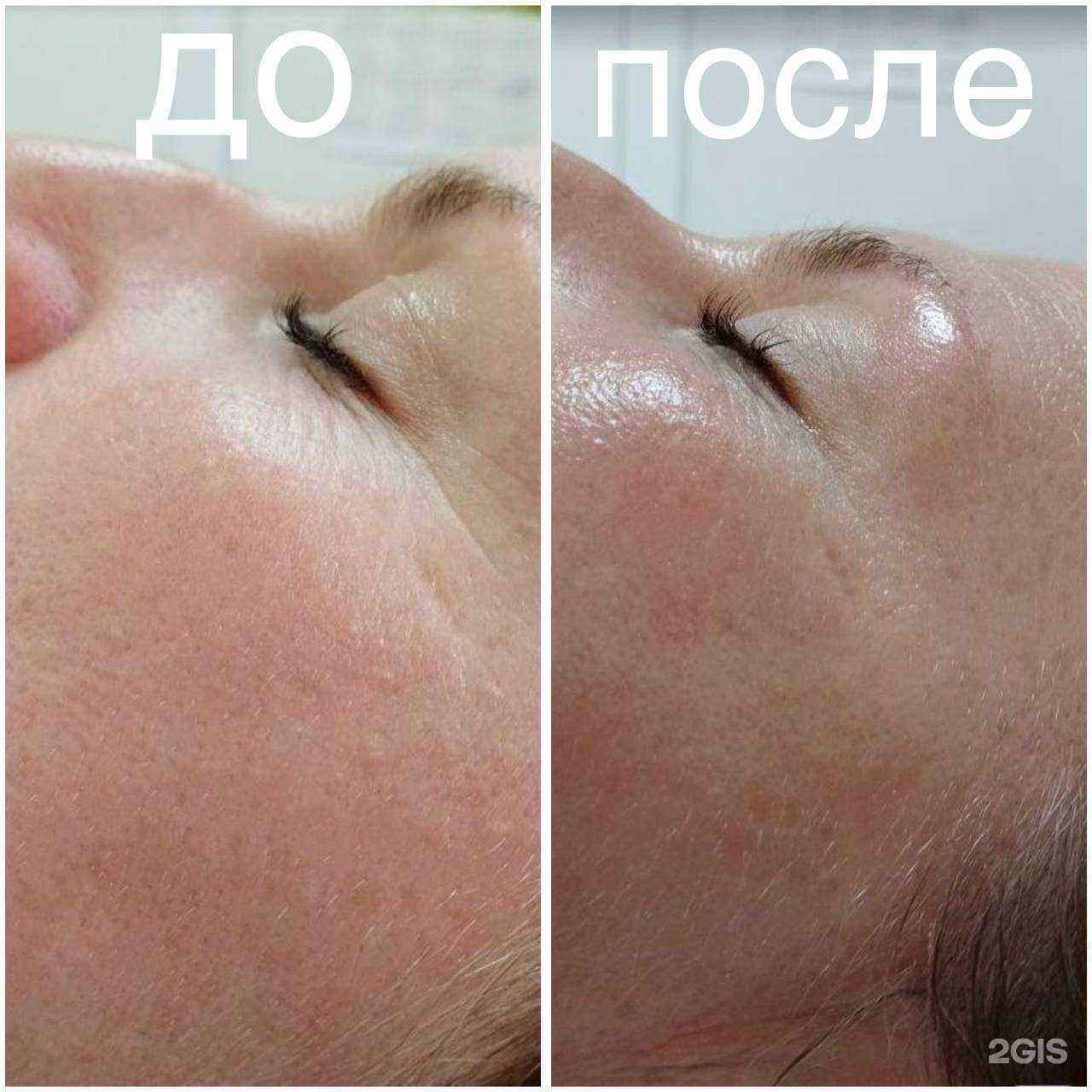 Отзывы на компанию Кабинет косметологии в Хабаровске c фото