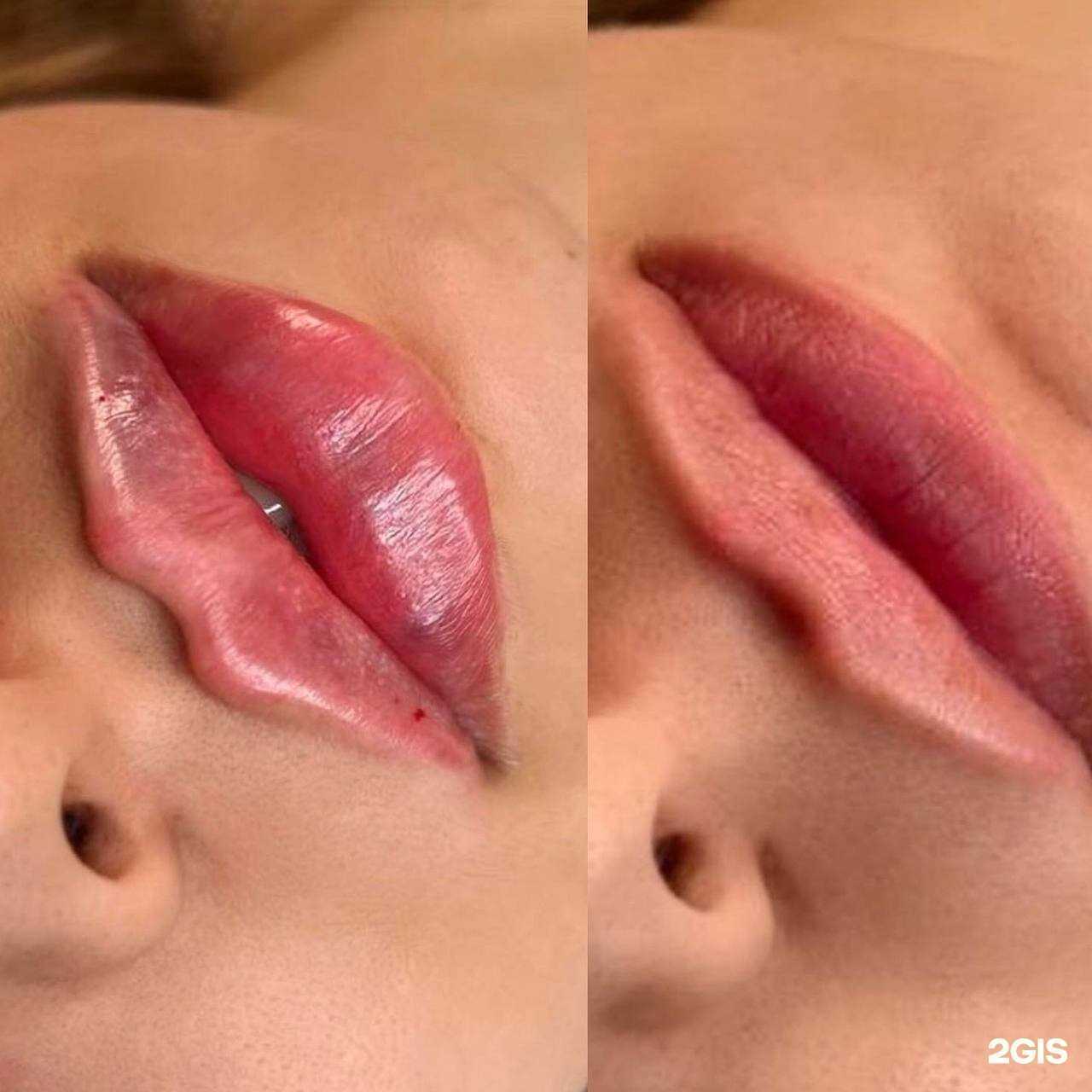 Отзывы на компанию Лазер и Точка в Ставрополе c фото