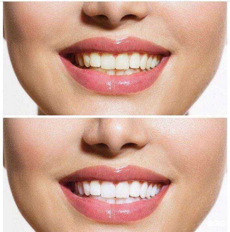 Отзывы на компанию Колот в Владивостоке c фото