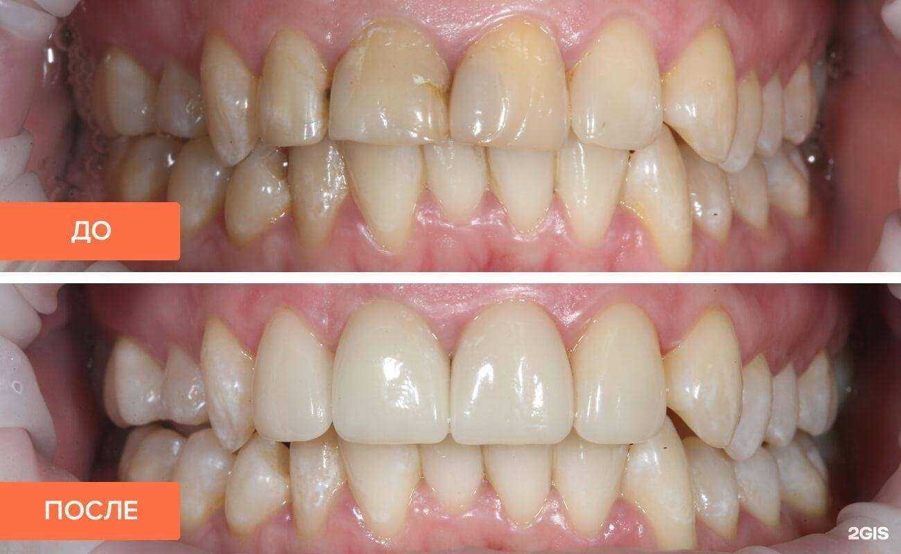 Отзывы на компанию Улыбка в Йошкар-Оле c фото