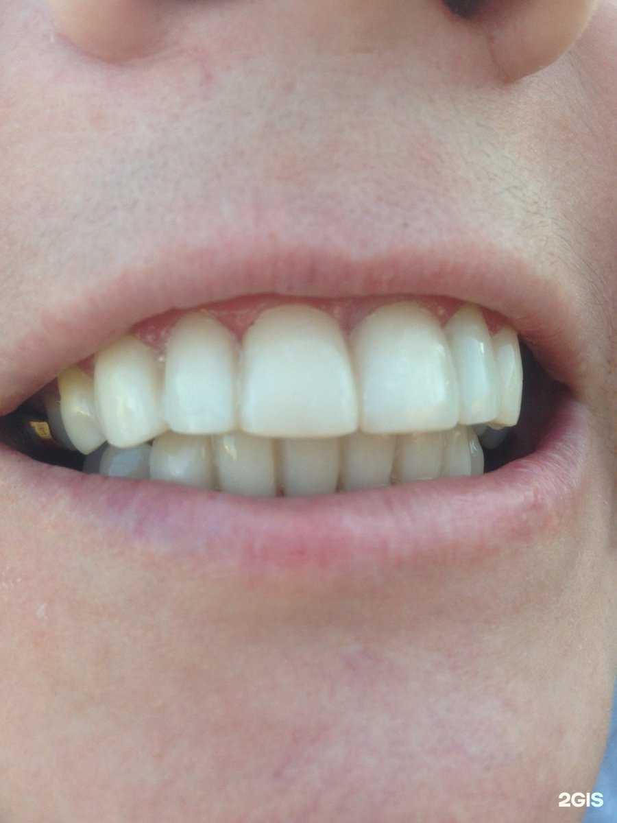 Отзывы на компанию Калина дент в г. Воронеж c фото