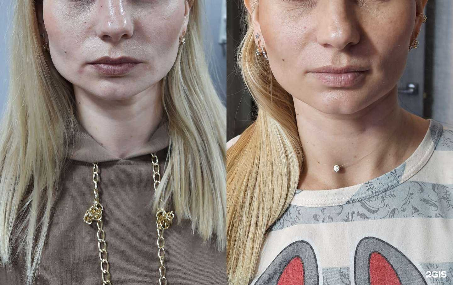 Отзывы на компанию Игла под ноготь в Омске c фото