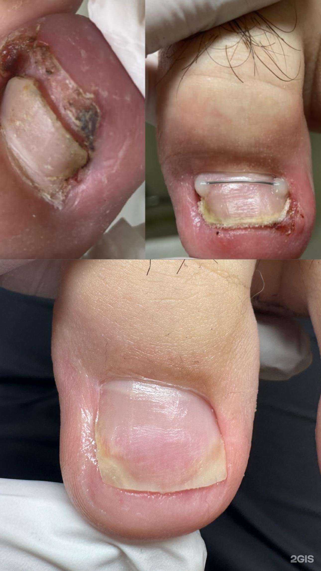 Отзывы на компанию Podopractice в Иркутске c фото