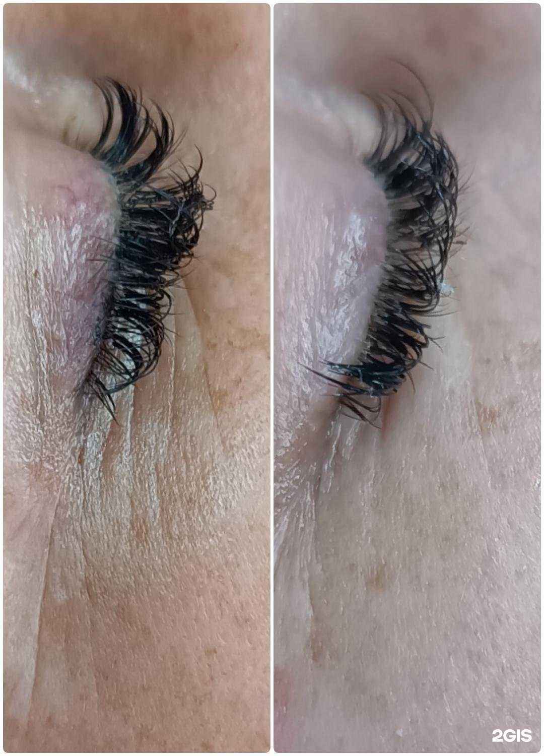 Отзывы на компанию Кабинет аппаратной косметологии для лица и тела в г. Гурьевск c фото