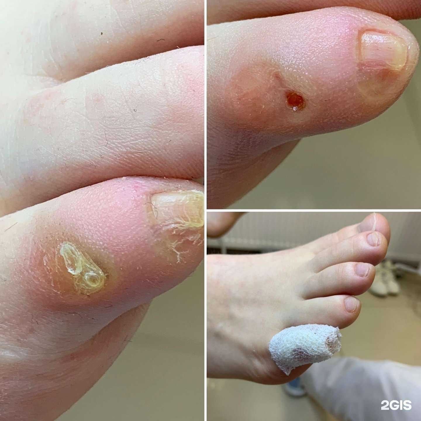 Отзывы на компанию Подология Елены Локтевой в Краснодаре c фото