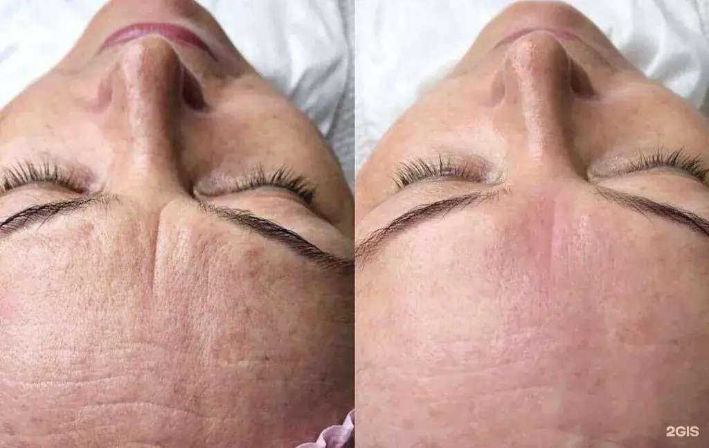 Отзывы на компанию Студия аппаратного массажа в г. Иваново c фото