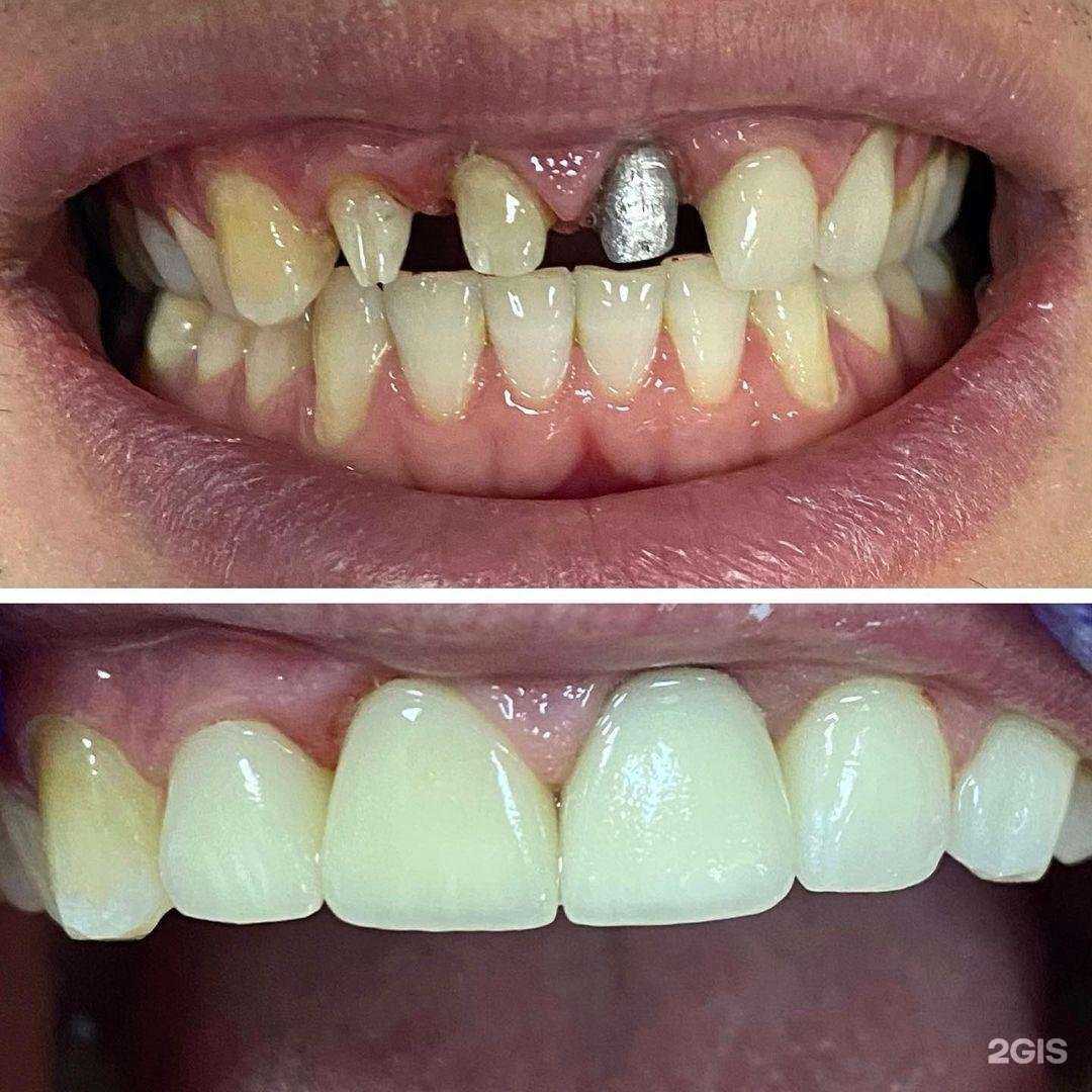 Отзывы на компанию Альфа Dent в Махачкале c фото