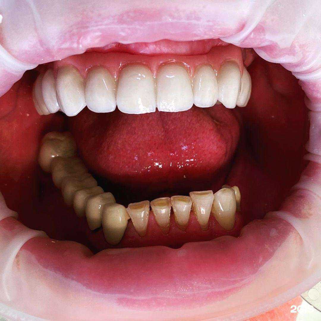 Отзывы на компанию Эстетика&имплантация в г. Сургут c фото