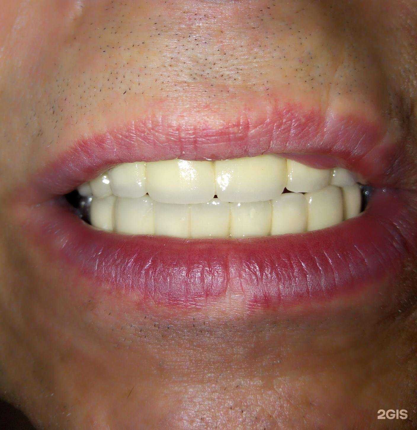 Отзывы на компанию Юдент в Перми c фото